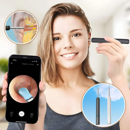 Nettoyeur oreille visuel intelligent